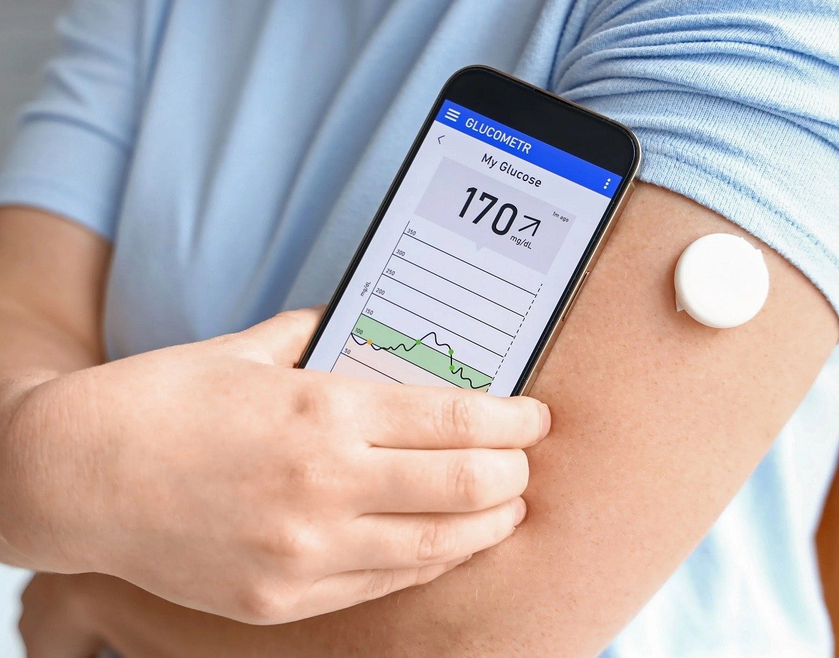 From Diet to Data: Blood Sugar Control Using Technology